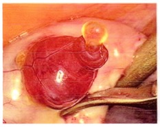 Pic 11. [Fig 8] OvulationPic