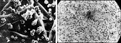 Image #23 Depleted Uranium Hollow Spherical Particulates (l) and Hot Particle Alpha Tracks in Lung Tissue (r)